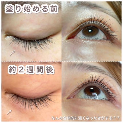 りちゃの正直レビュー日記📖 ́͏̖- on LIPS 「2週間使った経過記録//➡Qoo10で買えるまつ毛美容液はどの..」(5枚目)