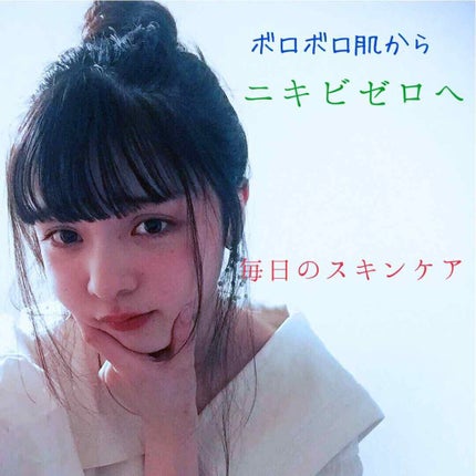 スキンケア洗顔料 薬用アクネケア/ビオレ/洗顔フォームを使ったクチコミ(1枚目)