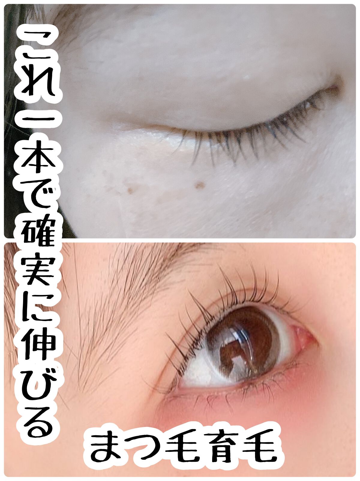 ラッシュアディクト アイラッシュコンディショニングセラム/soaddicted/まつげ美容液を使ったクチコミ(1枚目)