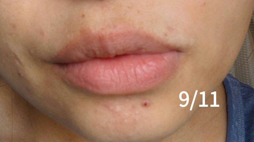 チョコラBBプラス (医薬品)/チョコラBB/その他を使ったクチコミ(3枚目)