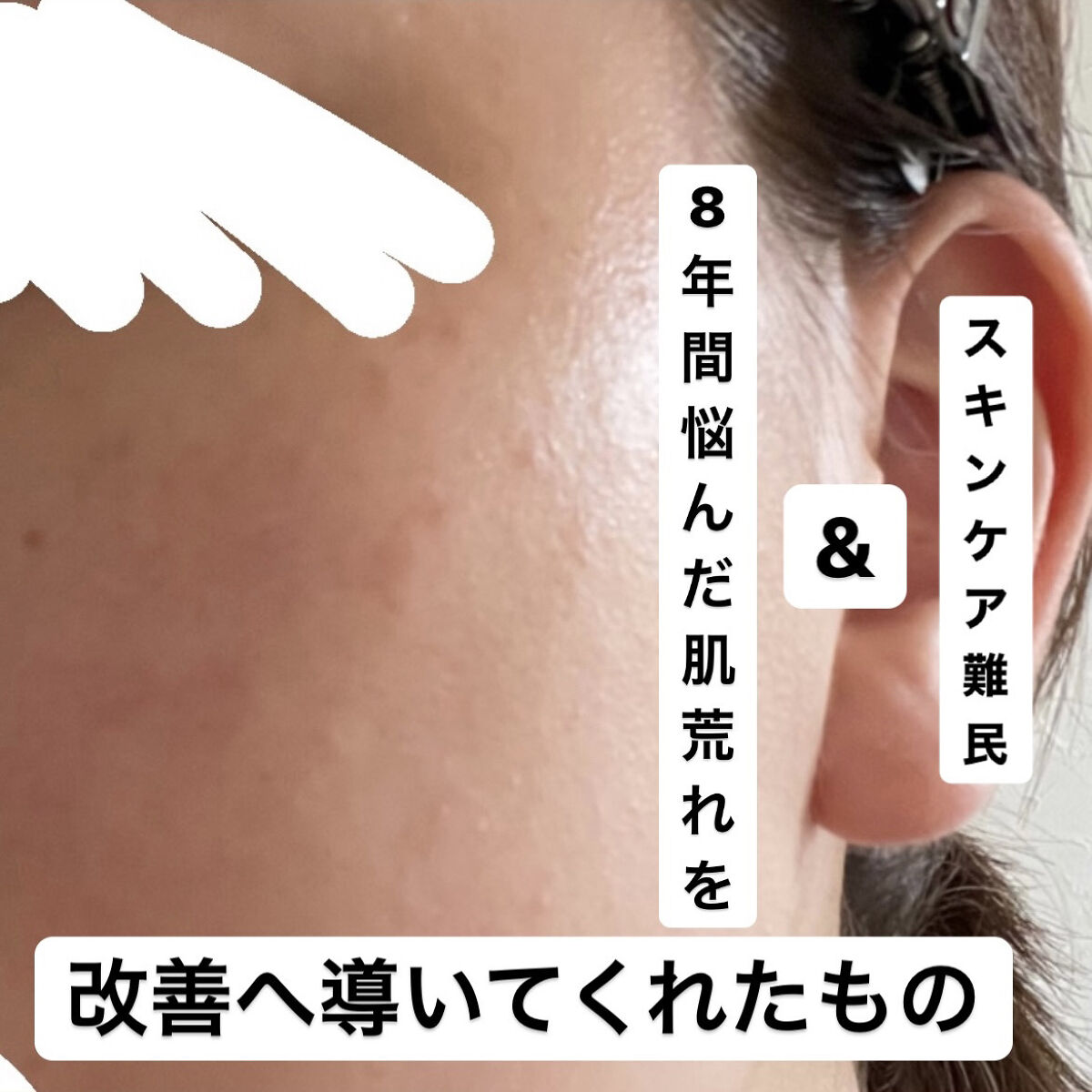 化粧水・敏感肌用・しっとりタイプ/無印良品/化粧水を使ったクチコミ（1枚目）