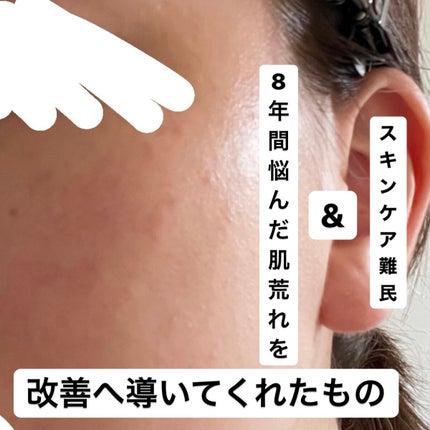 化粧水・敏感肌用・しっとりタイプ/無印良品/化粧水を使ったクチコミ(1枚目)