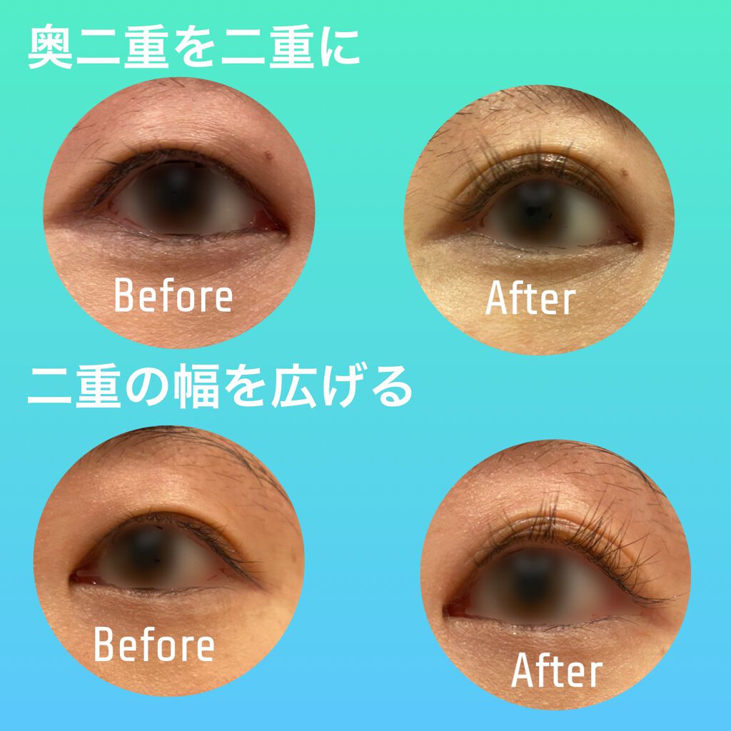 オリシキ アイリッドスキンフィルム /D-UP/二重まぶた用アイテムを使ったクチコミ(2枚目)