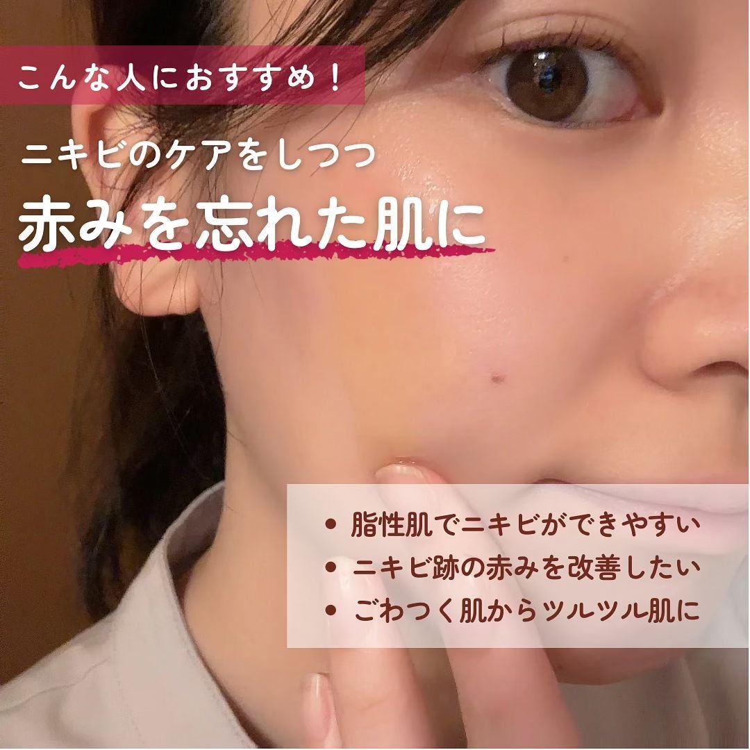 レッドアクネセラム/MEDICUBE/美容液を使ったクチコミ(5枚目)