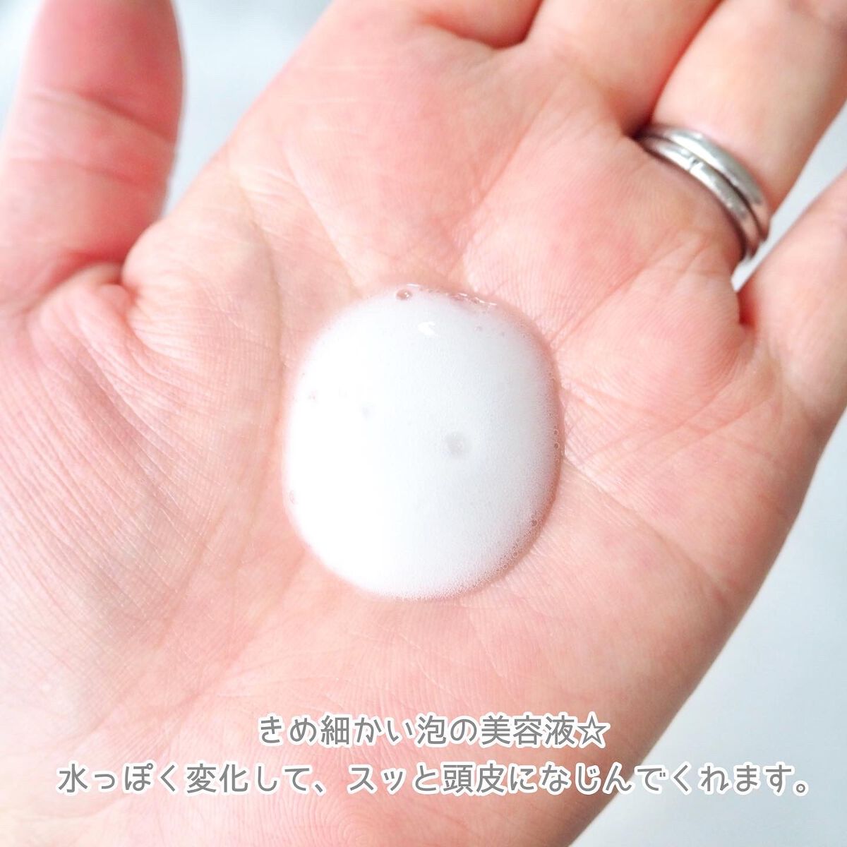 アクア チャージ ムース/ines/頭皮ローションを使ったクチコミ（3枚目）