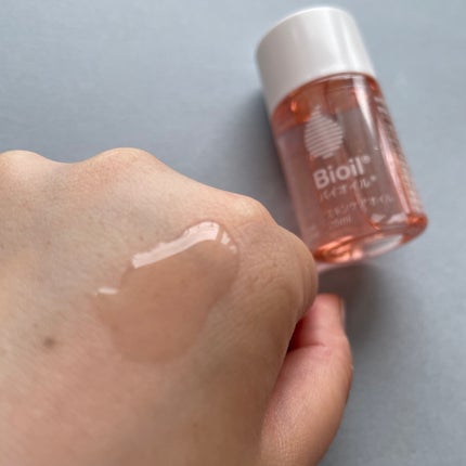 バイオイル/バイオイル/フェイスオイルを使ったクチコミ(2枚目)