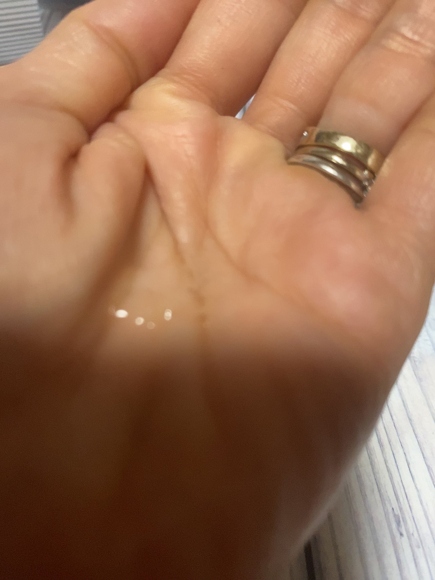 ミライナルX5/A style/頭皮ローションを使ったクチコミ(4枚目)