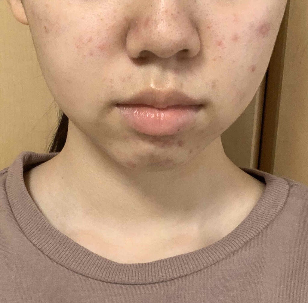 ハトムギ化粧水(ナチュリエ スキンコンディショナー R )/ナチュリエ/化粧水を使ったクチコミ(2枚目)