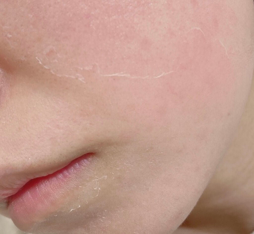 レチノールA 1% アドバンスドリバイタリゼーションクリーム/Life-flo/フェイスクリームを使ったクチコミ(4枚目)