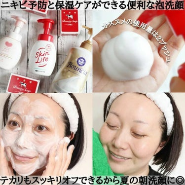 薬用泡のふんわり洗顔 160ml/スキンライフ/泡洗顔を使ったクチコミ（2枚目）