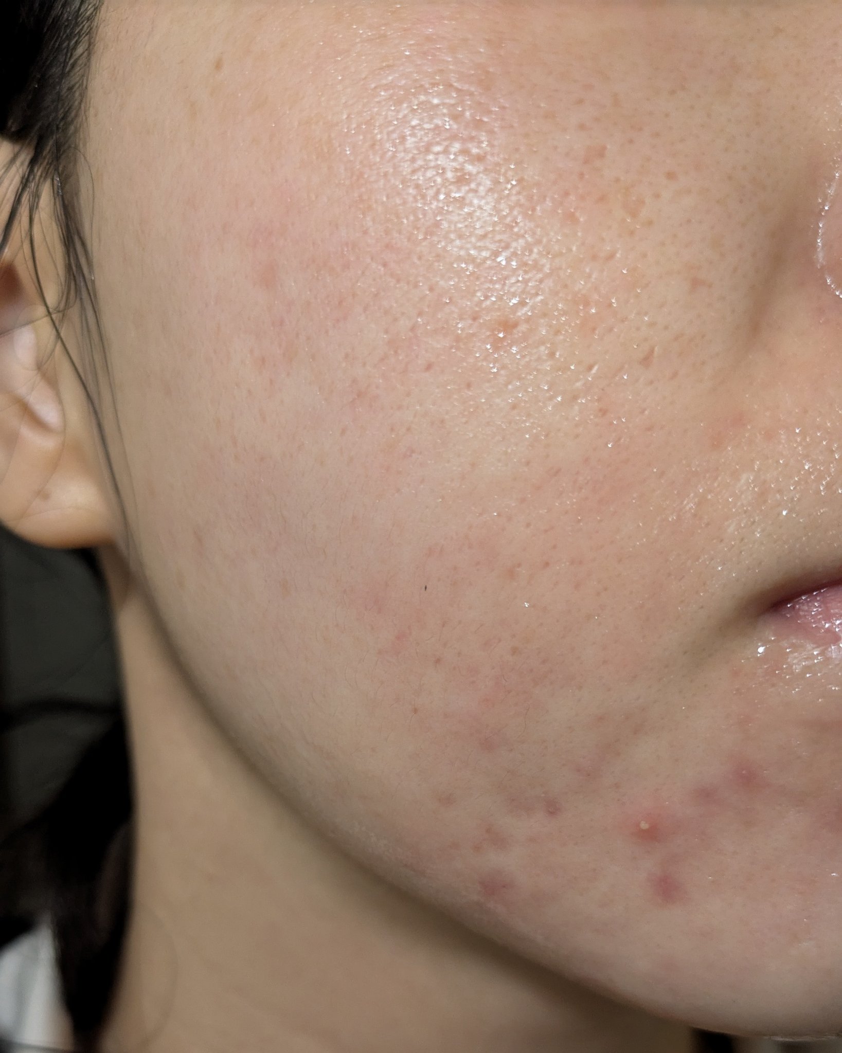 11/4の#汚肌工事録

😂