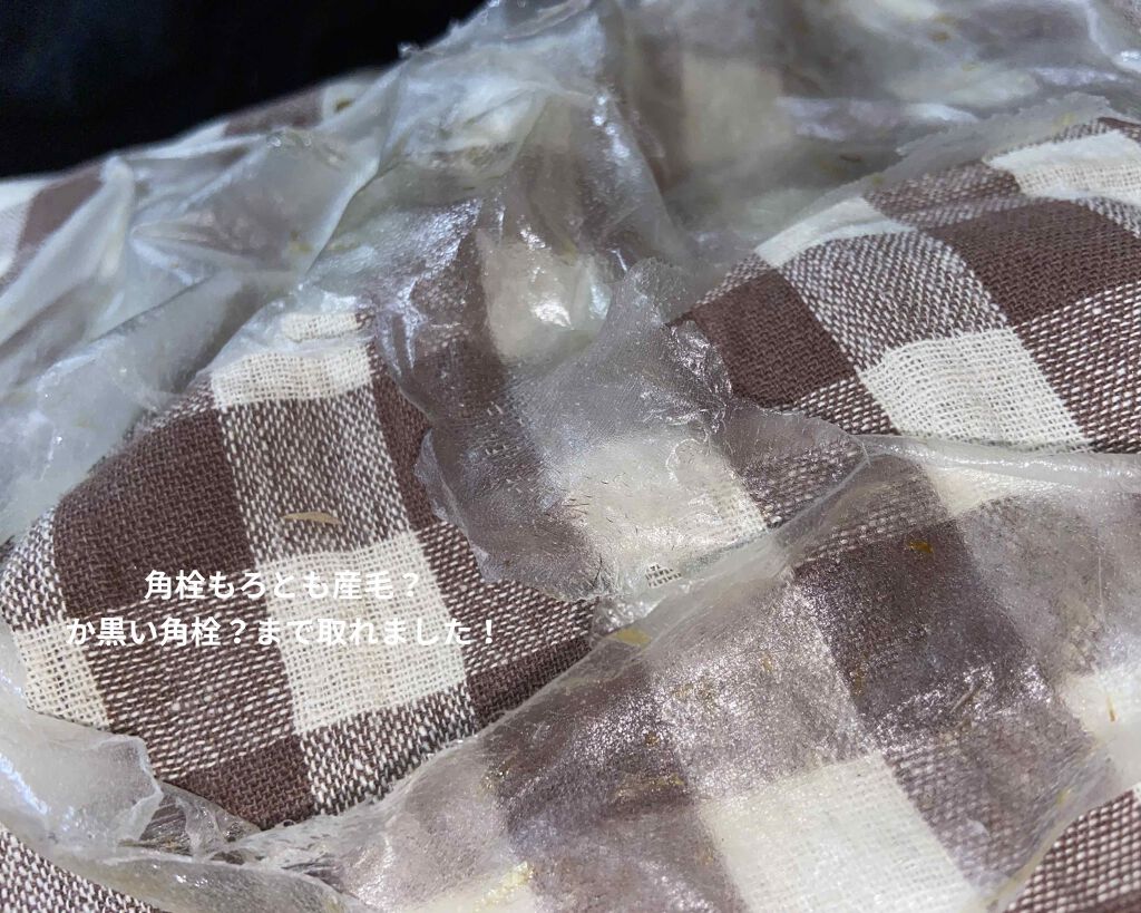 リアルカレンデュラピールオフパック/APRILSKIN/ピーリングを使ったクチコミ(2枚目)