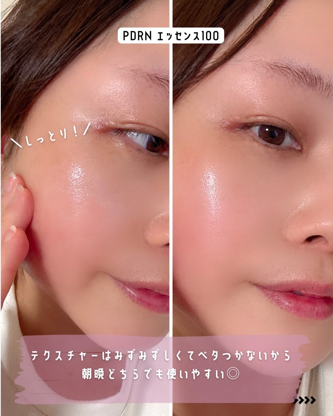 PDRNエッセンス100/VT/美容液を使ったクチコミ(5枚目)