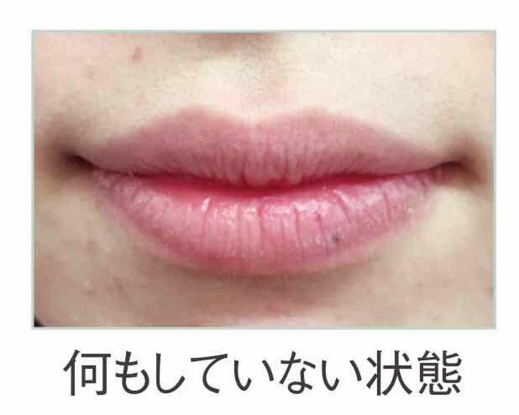 トリートメントリップ/ドクターリセラ/リップケアを使ったクチコミ(2枚目)