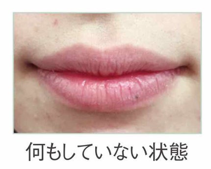 トリートメントリップ/ドクターリセラ/リップケアを使ったクチコミ(2枚目)