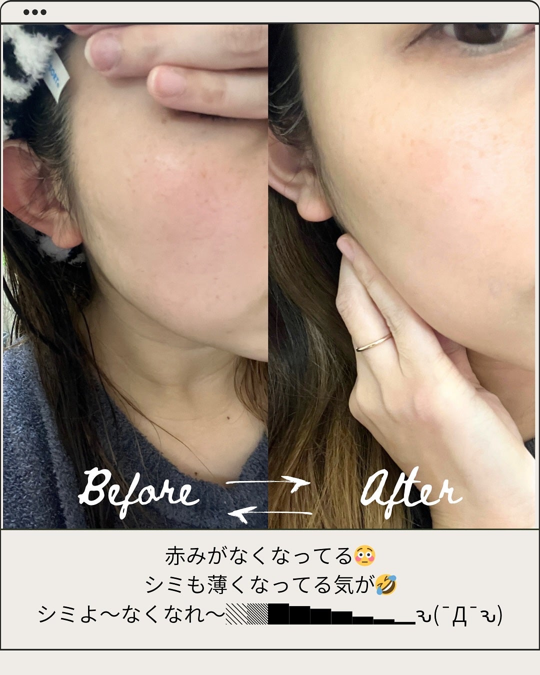 ビハククリアプレミアム/安心健康ライフ/オールインワン化粧品を使ったクチコミ(4枚目)