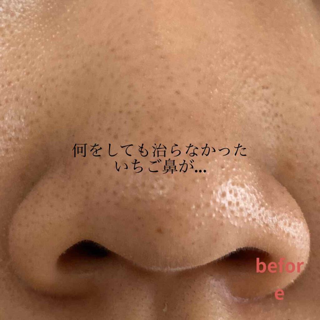 ソフティモ 薬用ホワイト クレンジングウォッシュ/ソフティモ/洗顔フォームを使ったクチコミ（1枚目）