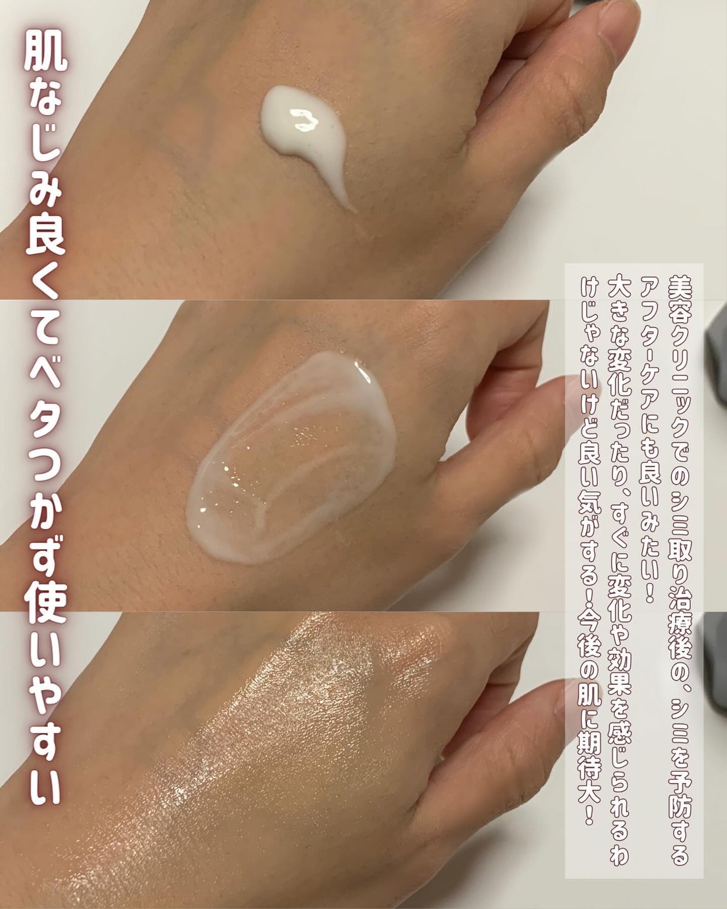 メラノショット ホワイト D/ONE BY KOSE/美容液を使ったクチコミ(4枚目)