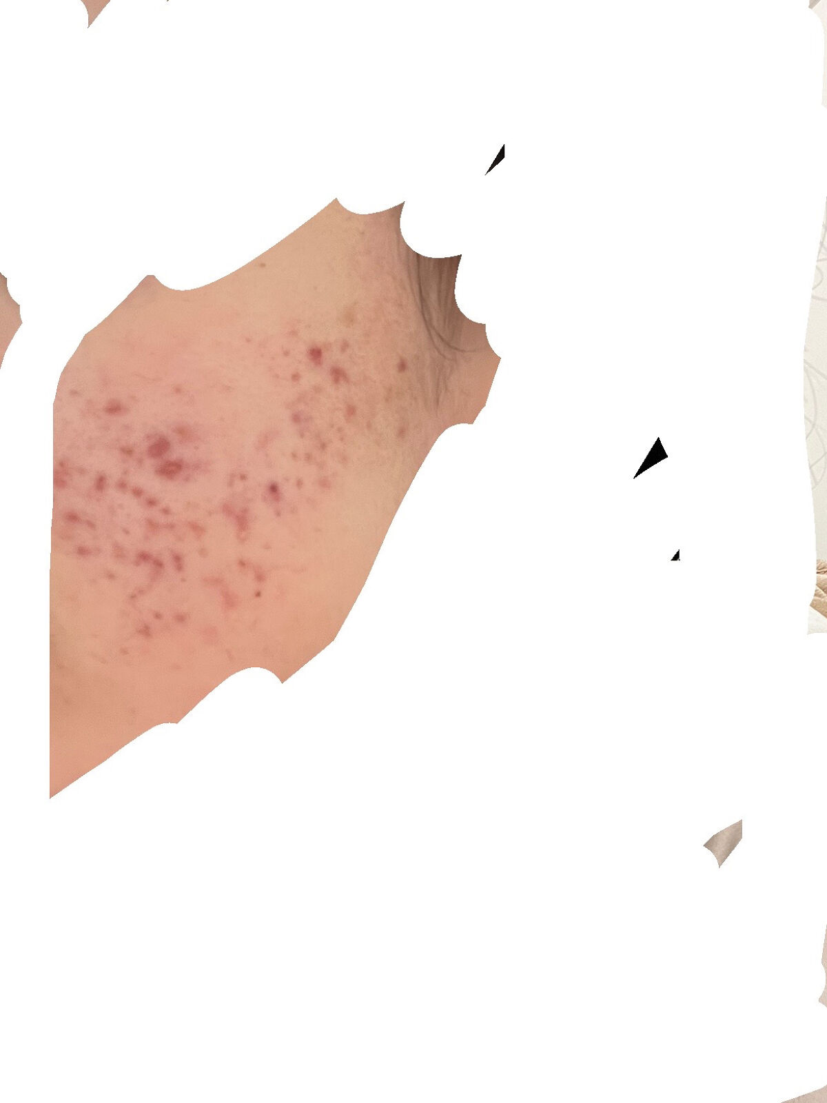 バランスアップ ローション(III)/アクアレーベル/化粧水を使ったクチコミ（2枚目）