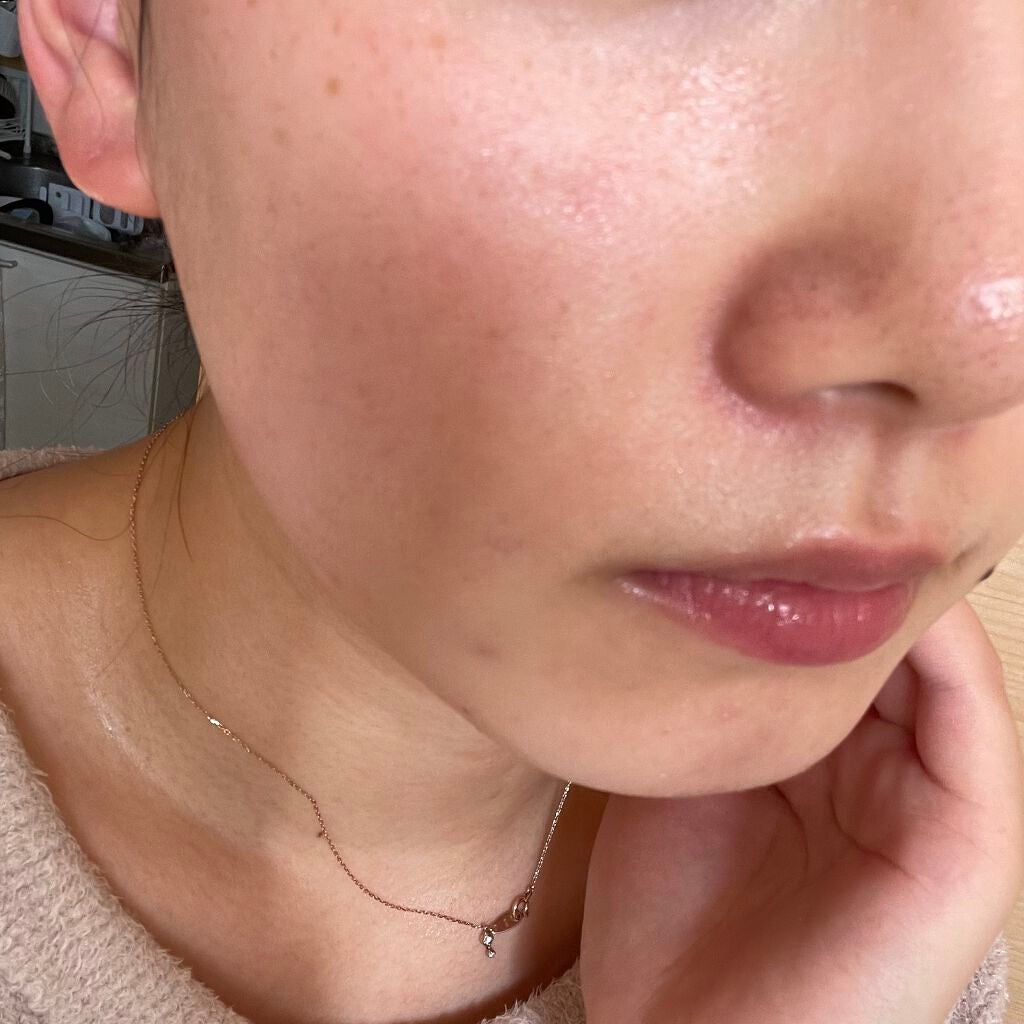 ごめんね素肌マスク/クリアターン/シートマスク・パックを使ったクチコミ(2枚目)