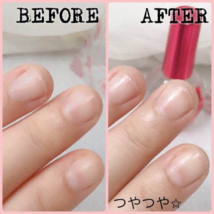 Meica ネイルオイル トゥルーローズ/MEICA/ネイルオイル・トリートメントを使ったクチコミ(7枚目)