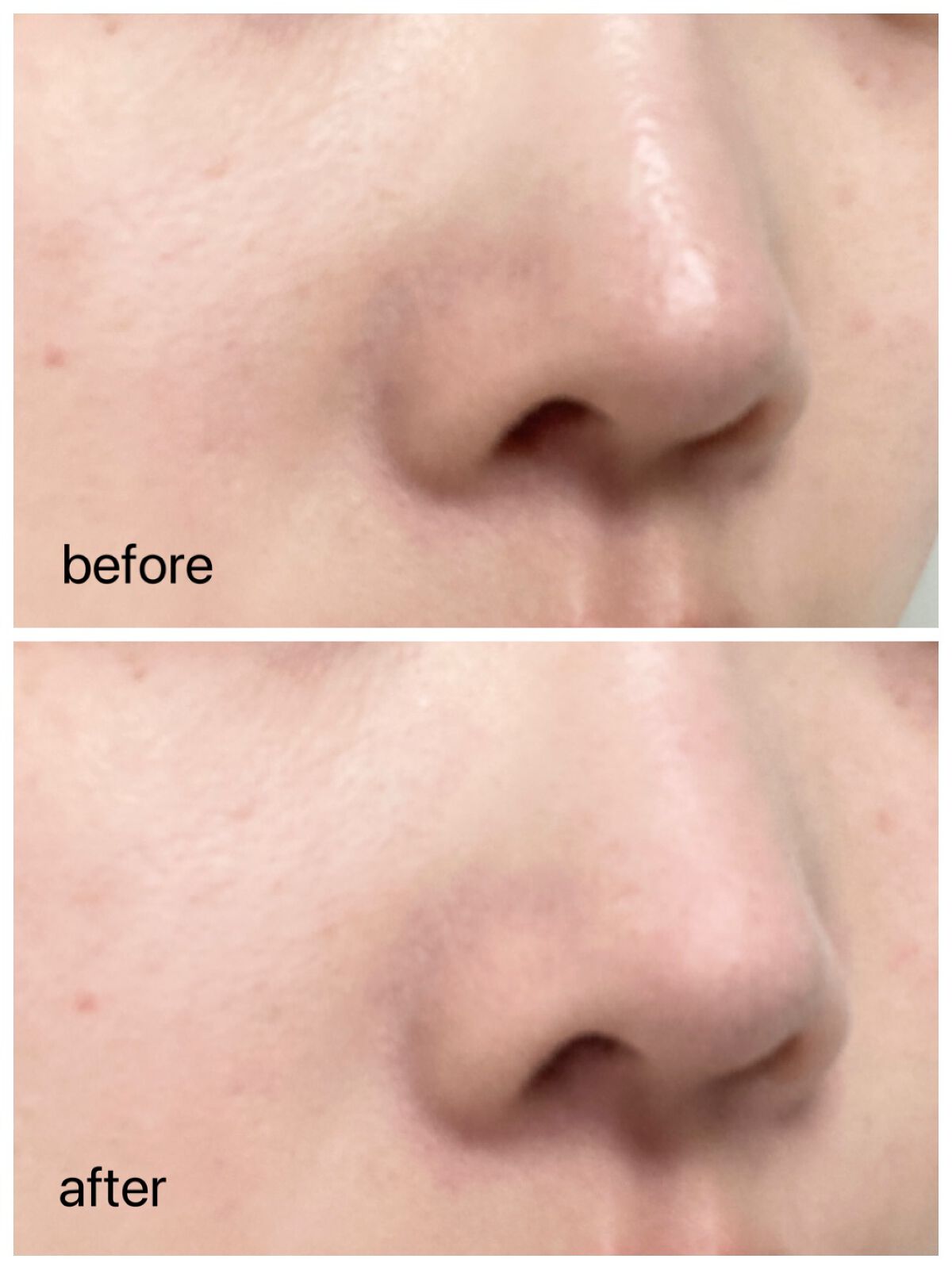 ポアセバムパウダー/One-day's you/ルースパウダーを使ったクチコミ(3枚目)