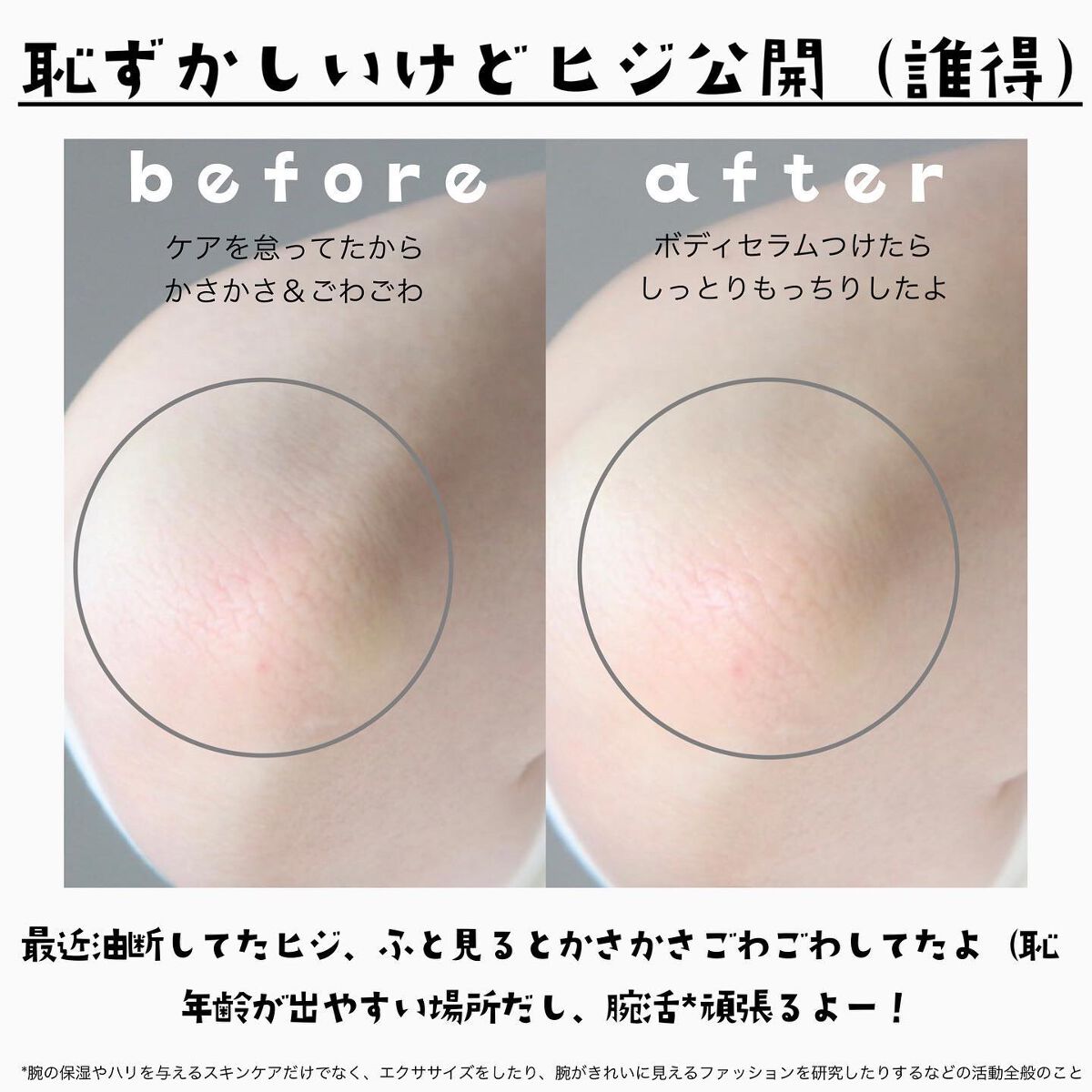 エスト インテンシブ ボディセラム/est/ボディクリームを使ったクチコミ(5枚目)