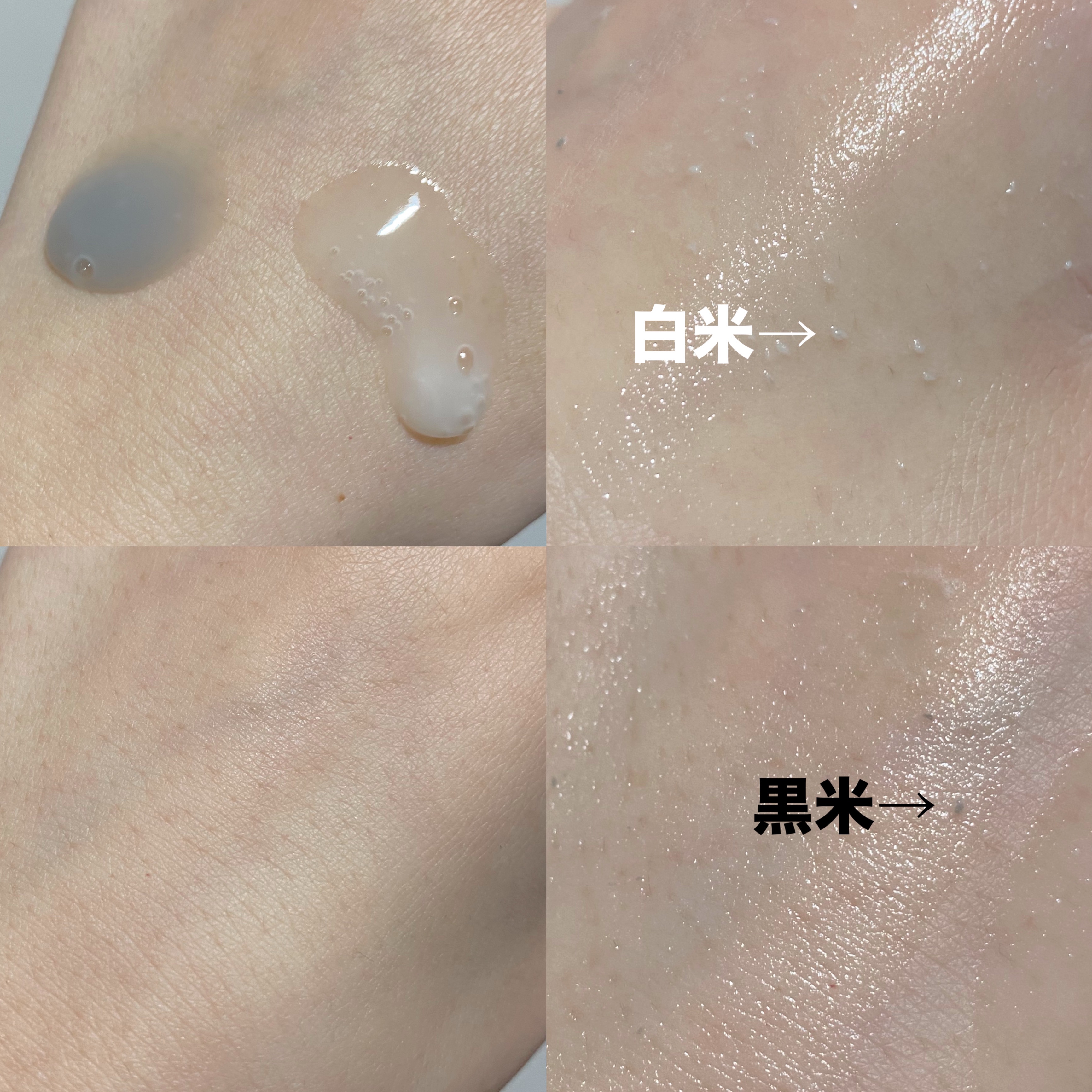 白米ピールショットゴマージュアンプル/Dr.Melaxin/美容液を使ったクチコミ（2枚目）