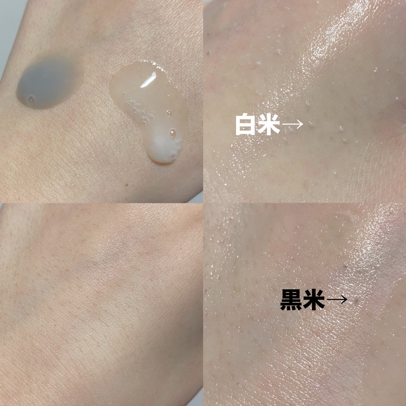 白米ピールショットゴマージュアンプル/Dr.Melaxin/美容液を使ったクチコミ(2枚目)