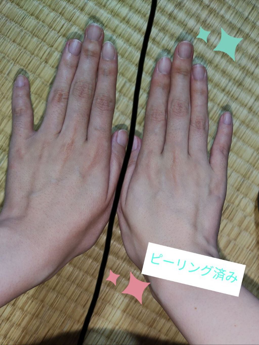 モイスト ピーリング ムース/MOCOLAB/ピーリングを使ったクチコミ(5枚目)