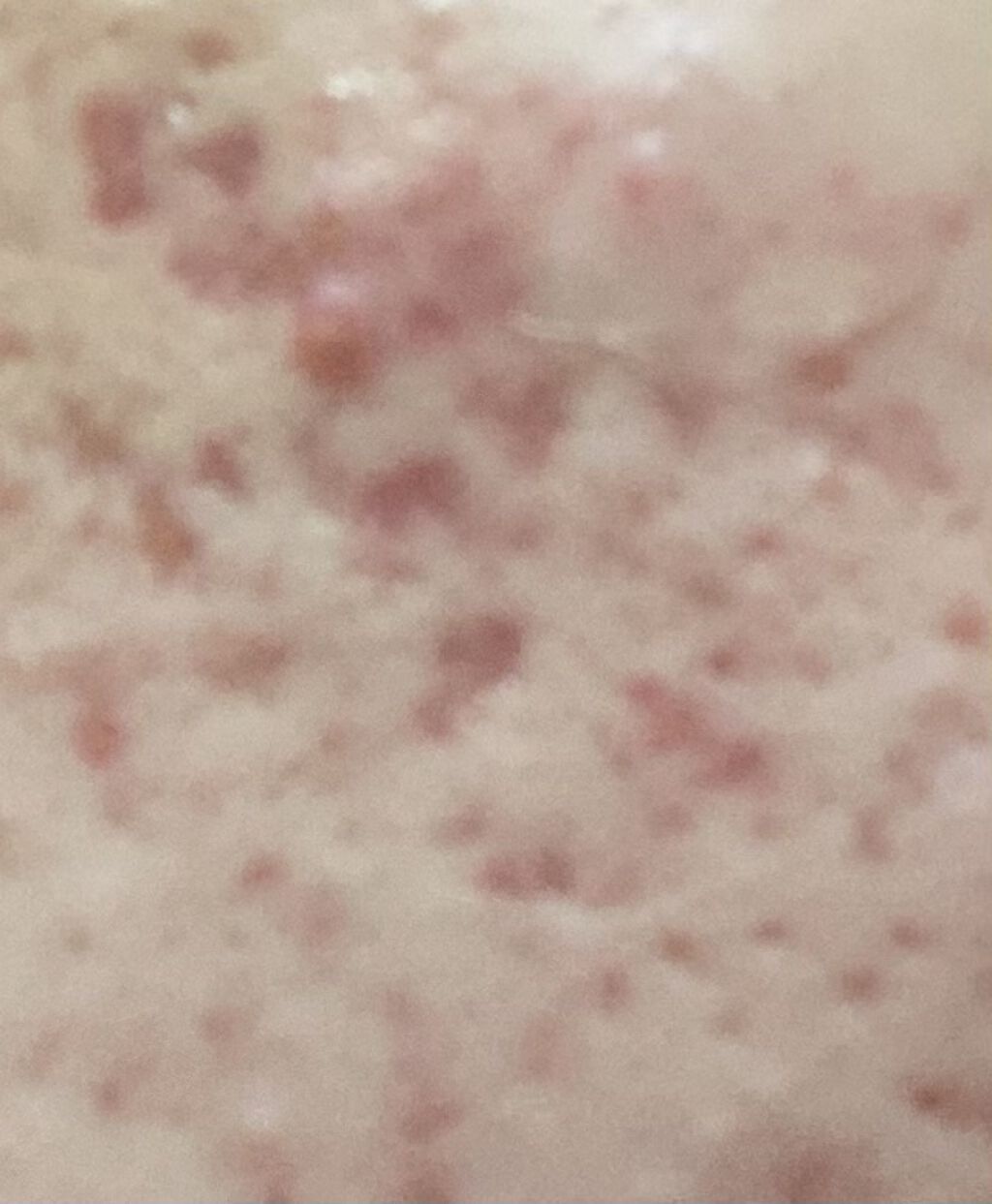 キールズ ミッドナイトボタニカル コンセントレート/Kiehl's/フェイスオイルを使ったクチコミ（2枚目）