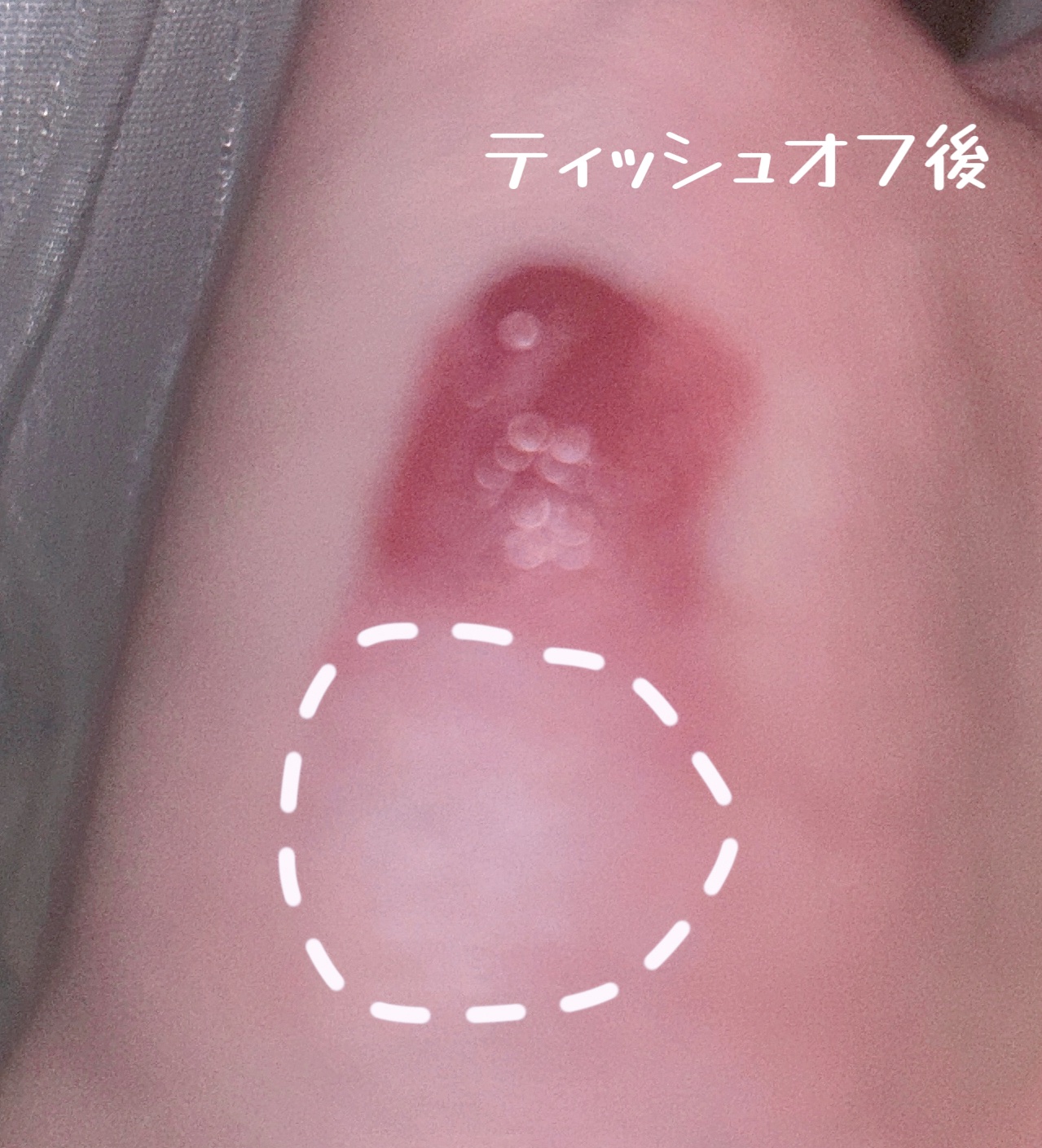 フィクシングティント/ETUDE/リップティントを使ったクチコミ（3枚目）