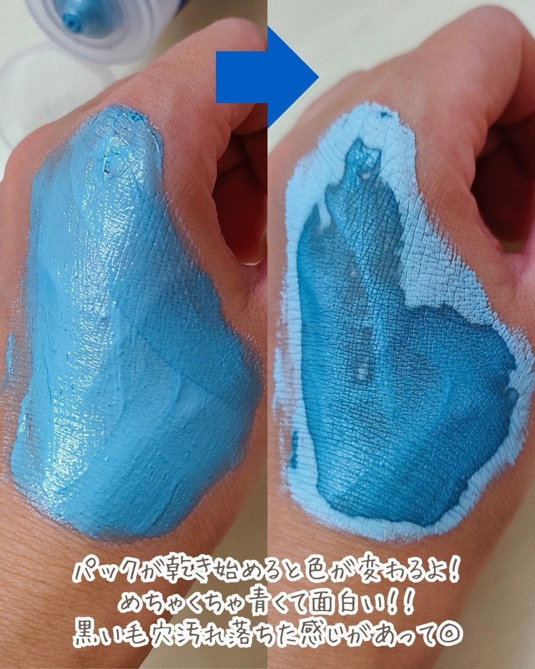 ゼロ毛穴パッド 2.0/MEDICUBE/トナーパッドを使ったクチコミ(4枚目)