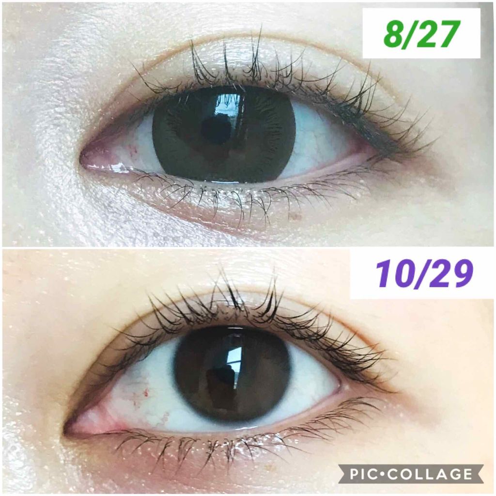 アヴァンセ ラッシュセラム EX(医薬部外品)/アヴァンセ/その他を使ったクチコミ(2枚目)