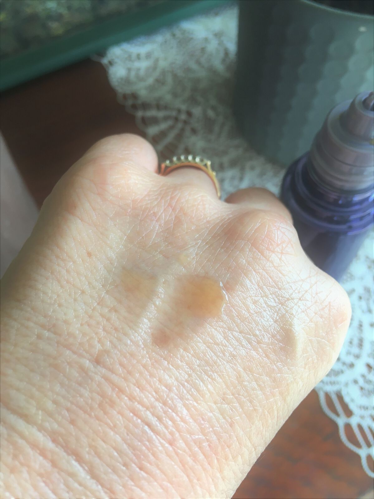 ヘアリッチローション/リソウコーポレーション/頭皮ローションを使ったクチコミ（2枚目）