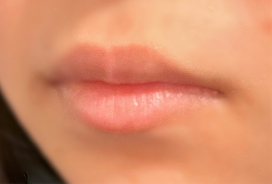 メンソレータム リップフォンデュ/メンソレータム/リッププランパーを使ったクチコミ（1枚目）