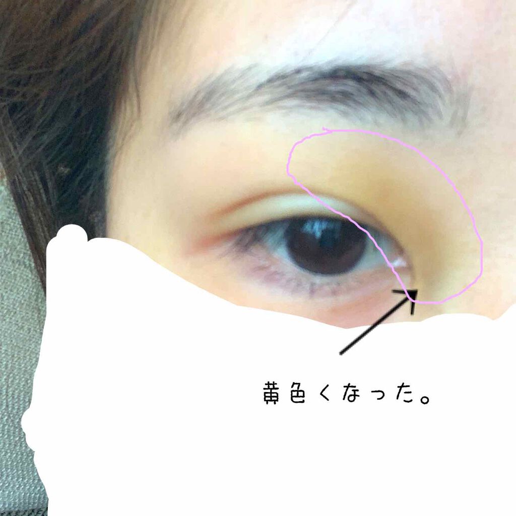 さとう on LIPS 「SBCフォーエバー二重から四日目昨日は特に変わりありませんでし..」(2枚目)