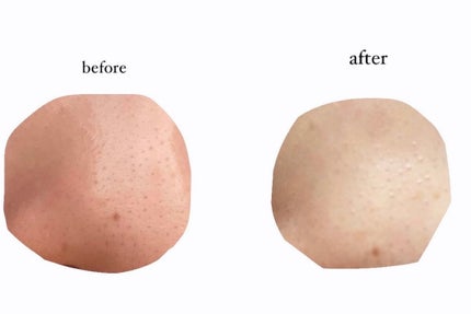 毛穴小町 ブラックピールオフパック/クリアターン/ピーリングを使ったクチコミ(3枚目)