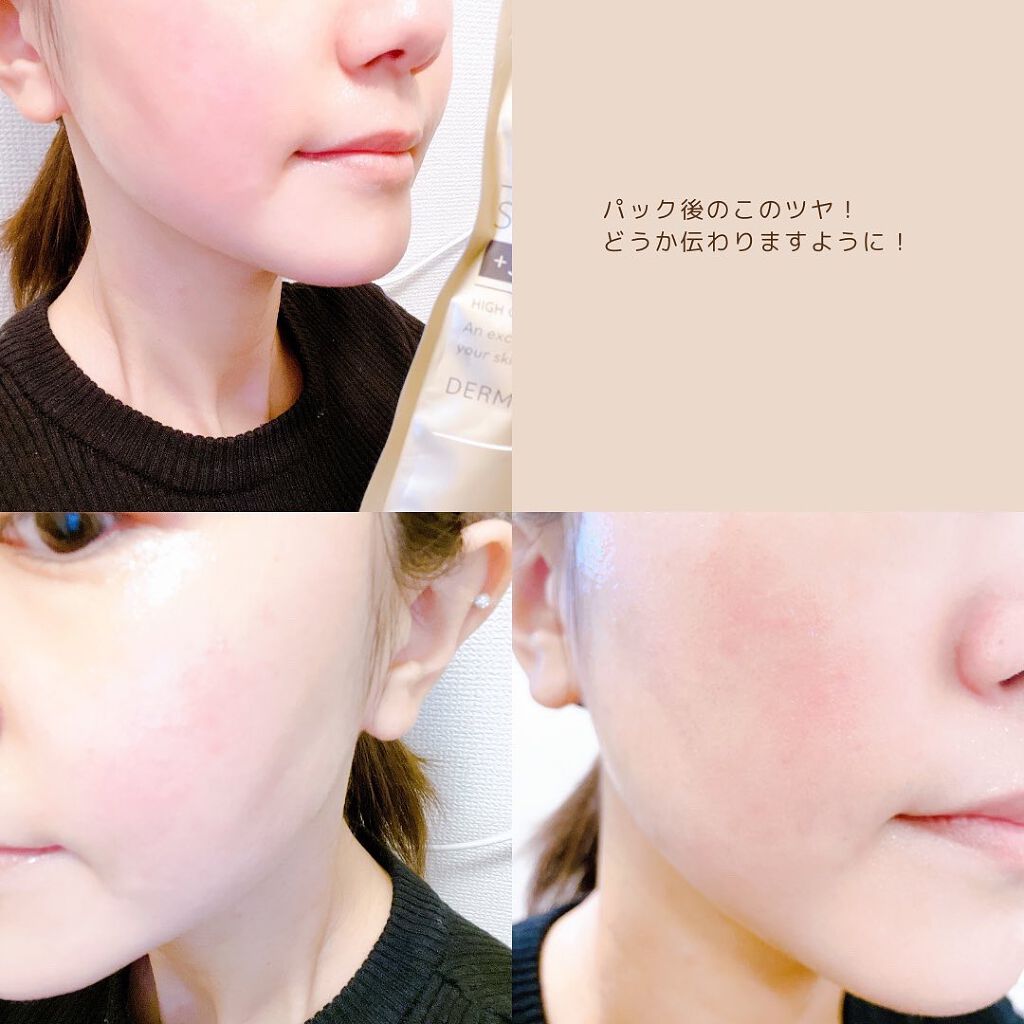 ダーマレーザースーパーVC100マスク/クオリティファースト/シートマスク・パックを使ったクチコミ(5枚目)
