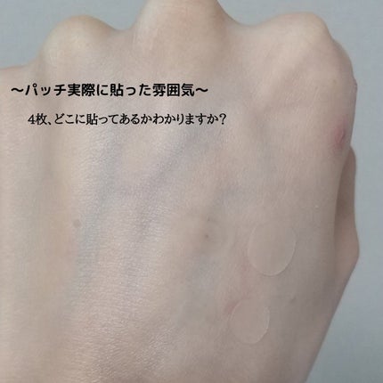 カーミングクリアスポットパッチ/Pyunkang Yul/にきびパッチを使ったクチコミ(5枚目)
