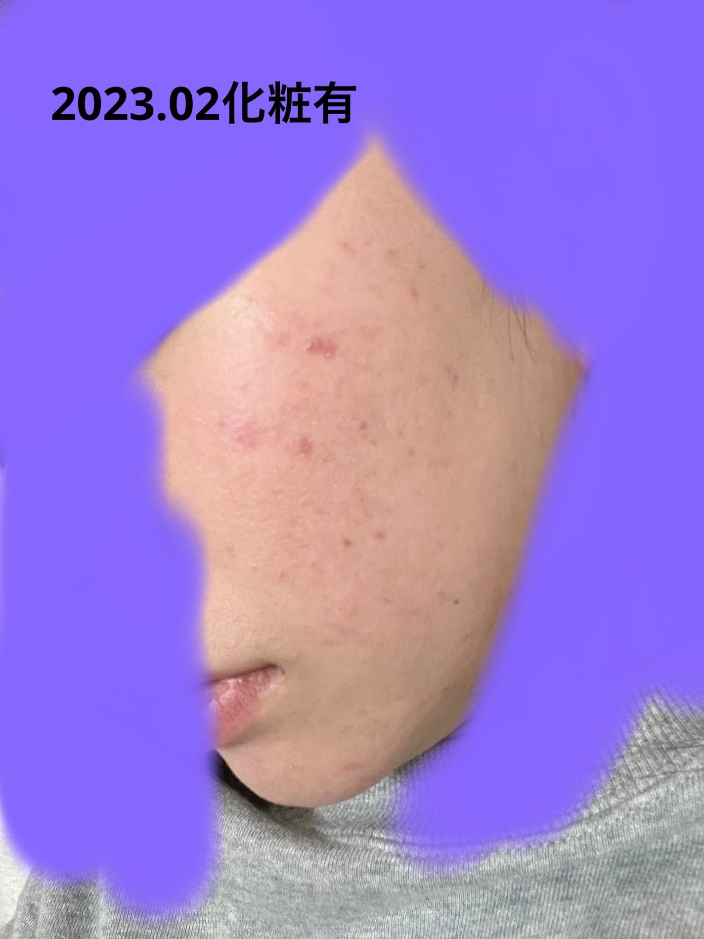 ã¢ã¢ð on LIPS ãæçš¿ããããŠããŸããŸããïŒäžå¹Žåãã¡ã³ããŒã·ã§ã³ããŠãèµ€ã¿ãã..ãïŒ2æç®ïŒ