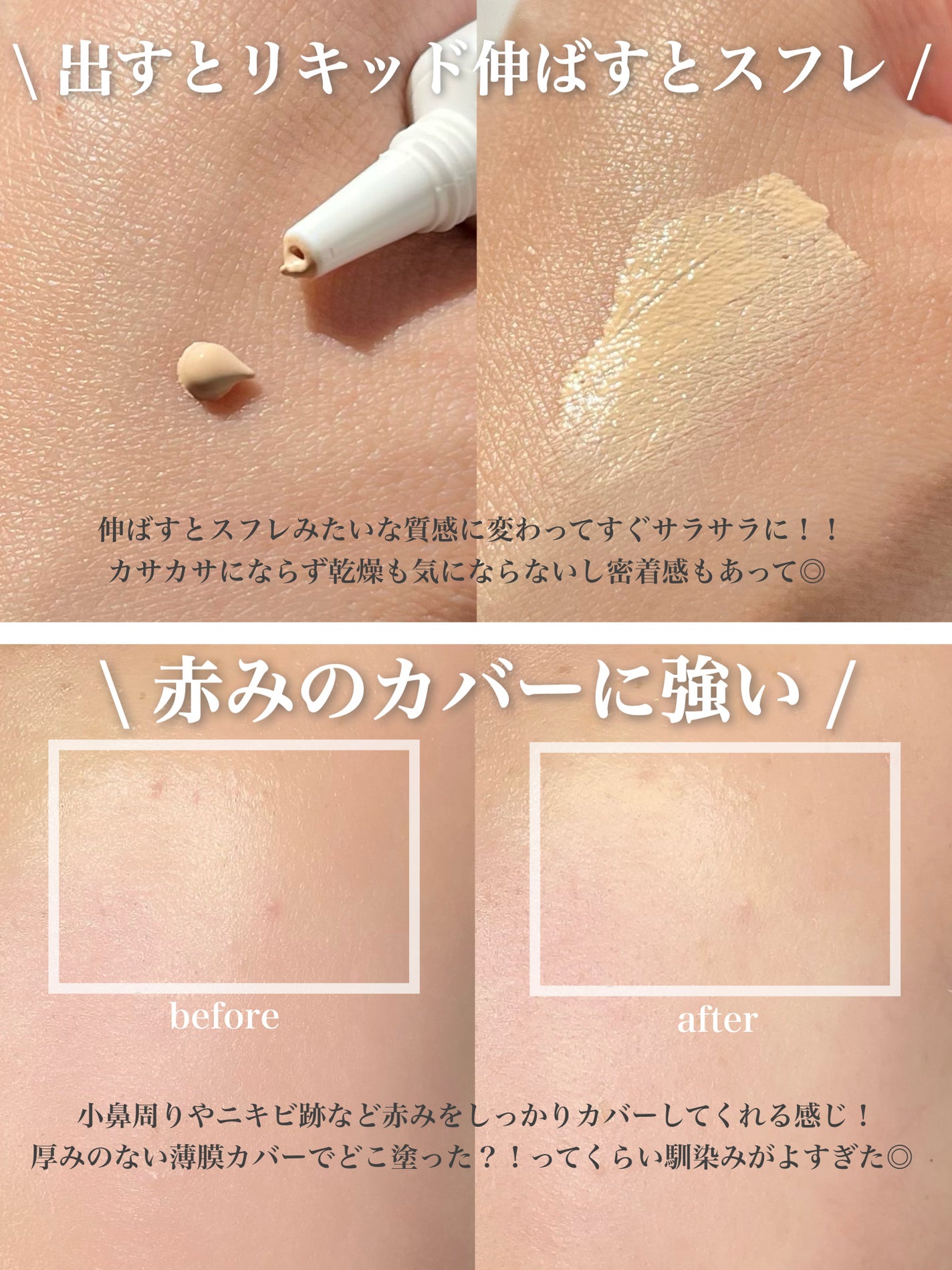 イプノス シーバムクリア リペアクリーム/ACSEINE/フェイスクリームを使ったクチコミ(3枚目)