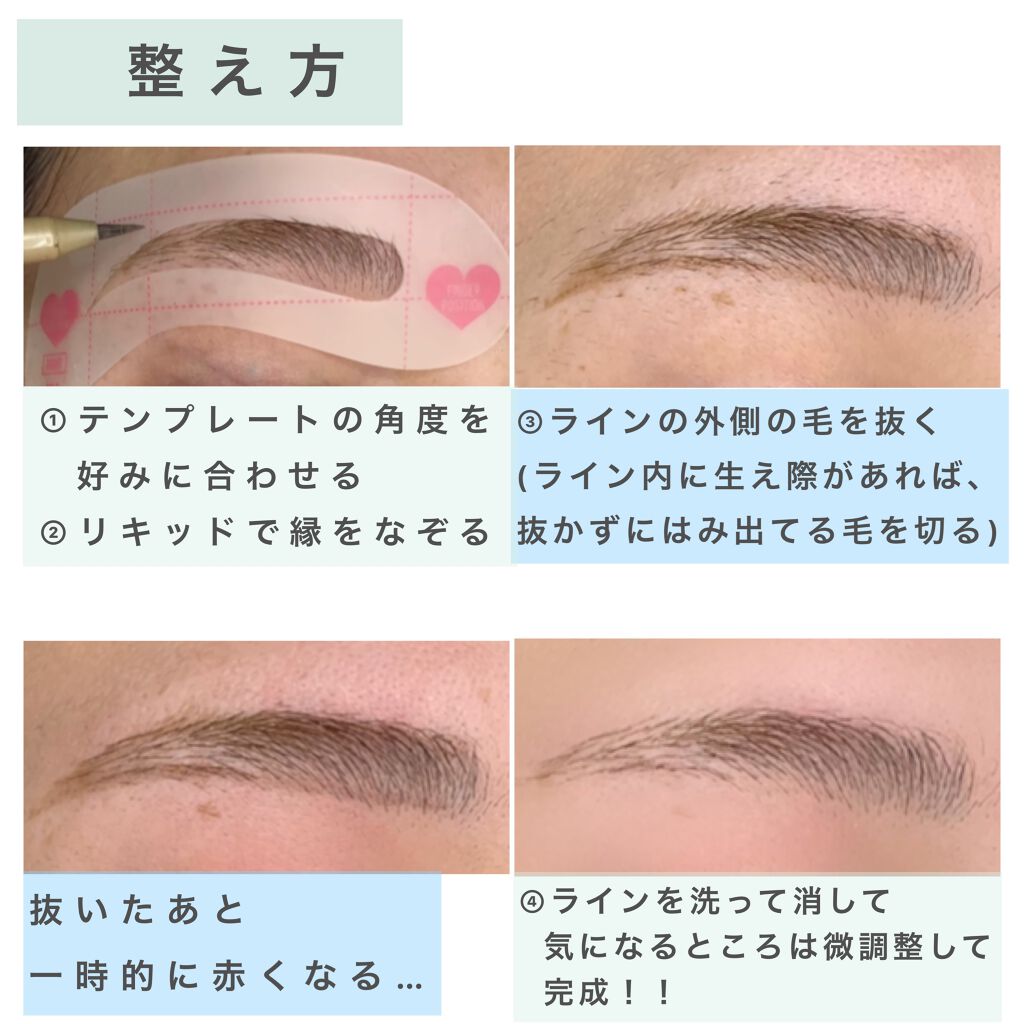 脱色クリーム スピーディー/エピラット/ムダ毛ケアを使ったクチコミ(4枚目)