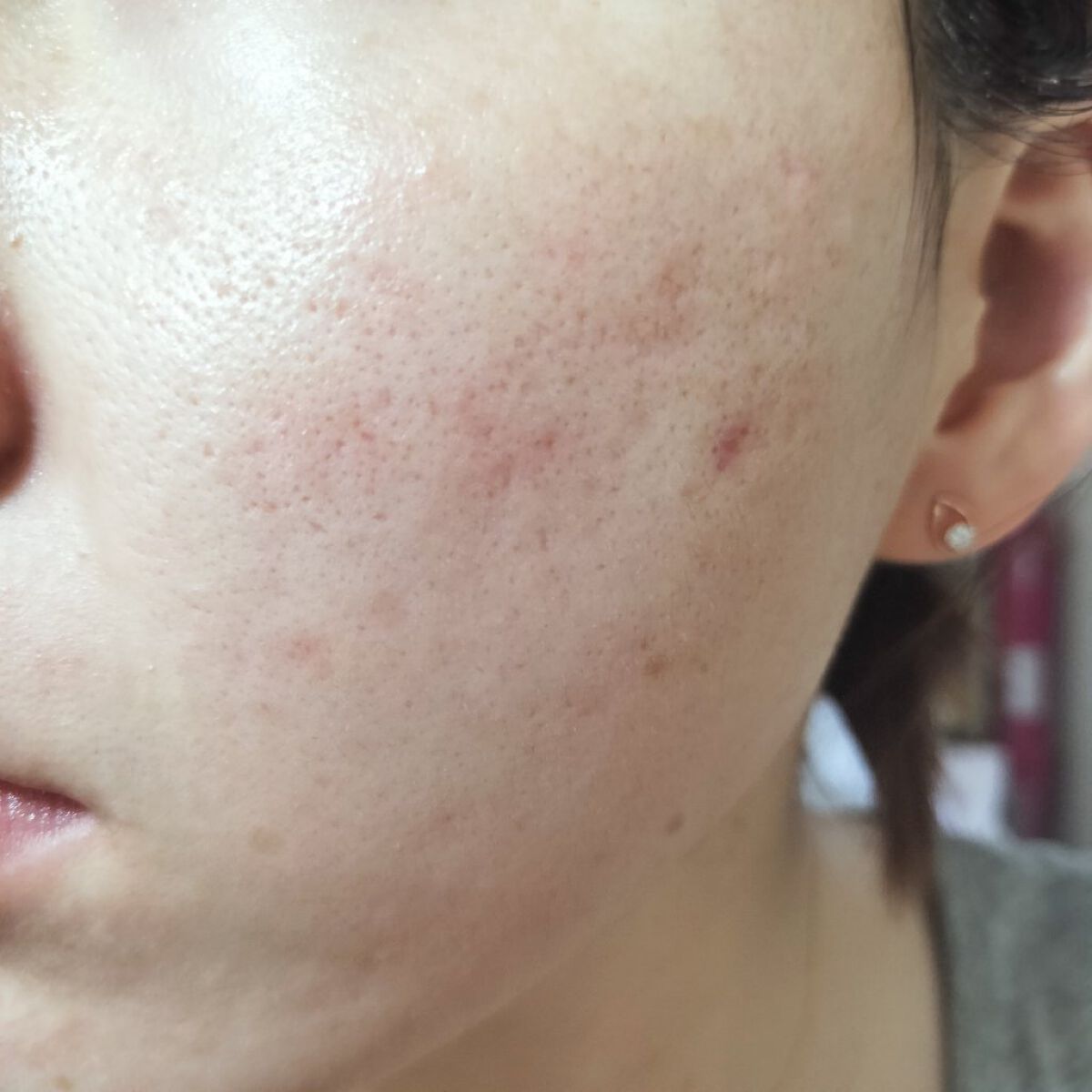 100プラントベースS/The Ordinary/美容液を使ったクチコミ（2枚目）