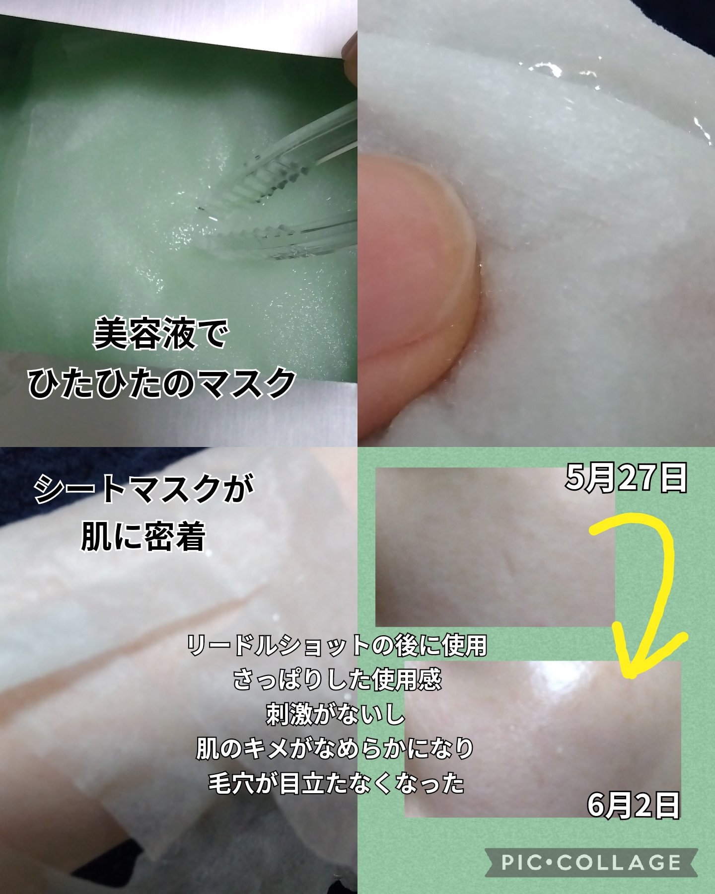 ピーディーアールエヌエッセンス PDRN 100/VT/美容液を使ったクチコミ（3枚目）