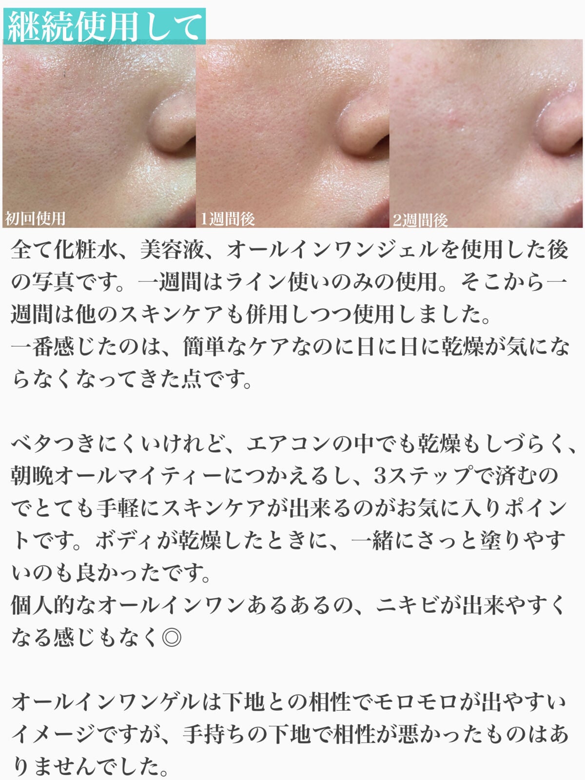 シナジーディフェンス ローション/Ms.SYNERGY/化粧水を使ったクチコミ(4枚目)