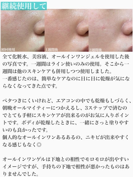 シナジーディフェンス ローション/Ms.SYNERGY/化粧水を使ったクチコミ(4枚目)