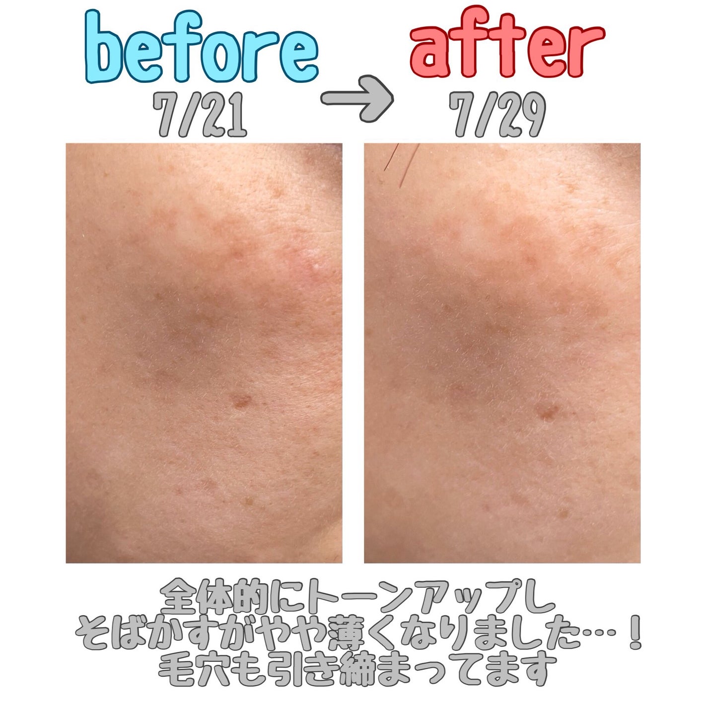 リードルショット100/VT/美容液を使ったクチコミ(4枚目)