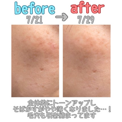 リードルショット100/VT/美容液を使ったクチコミ(4枚目)