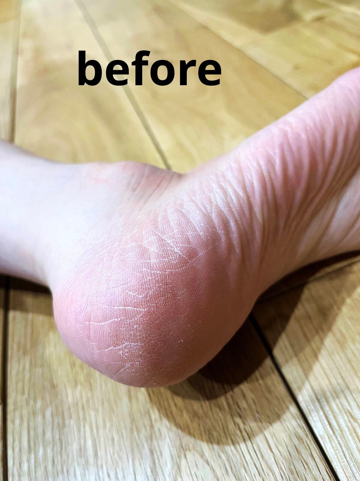 イージーパックDP60分タイプ/ベビーフット/レッグ・フットケアを使ったクチコミ(5枚目)